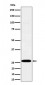 Anti-C1QA Rabbit Monoclonal Antibody